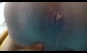 Guy Unleashes a Stream of Hot Poop