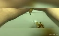 Close up of hairy wife shitting