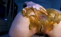 Girl shitting diarrea fisting asshole and prolapse