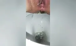 Piss and poop closeup 