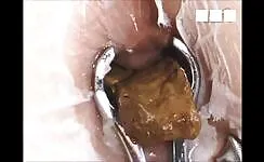 Deep inside the asshole 