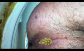 Man Gets Shit on His Asshole