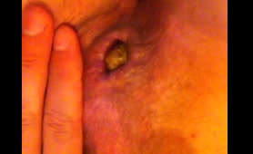 Close Up of a Lady Pooping