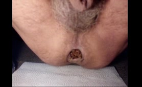 Painter Poops on a Napkin