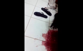 Drunk Lady Pukes and Poops